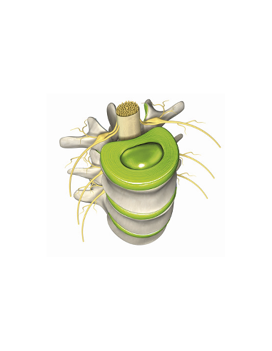 Vertebene Pack 2 cajas