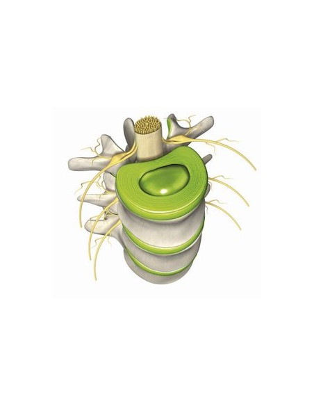Vertebene Pack 3 cajas
