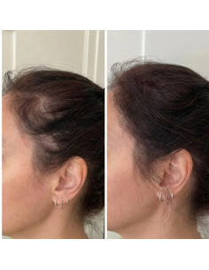 ROOT COVER DARK BROWN 2