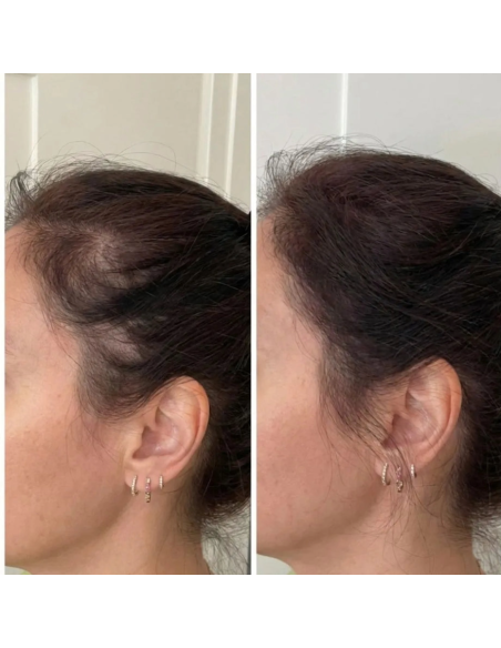 ROOT COVER DARK BROWN